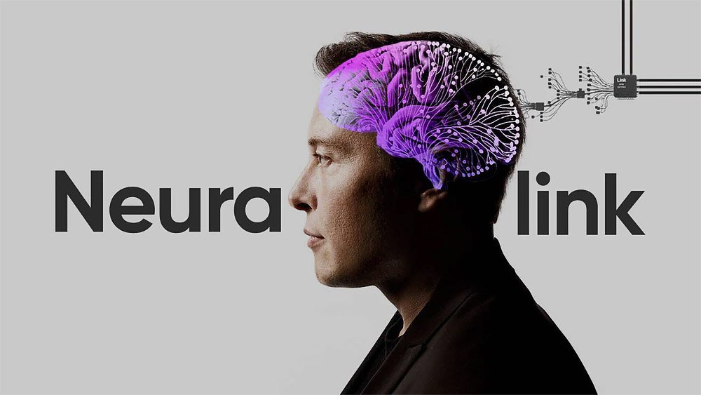 Neuralink realizó su primer implante cerebral en un ser humano